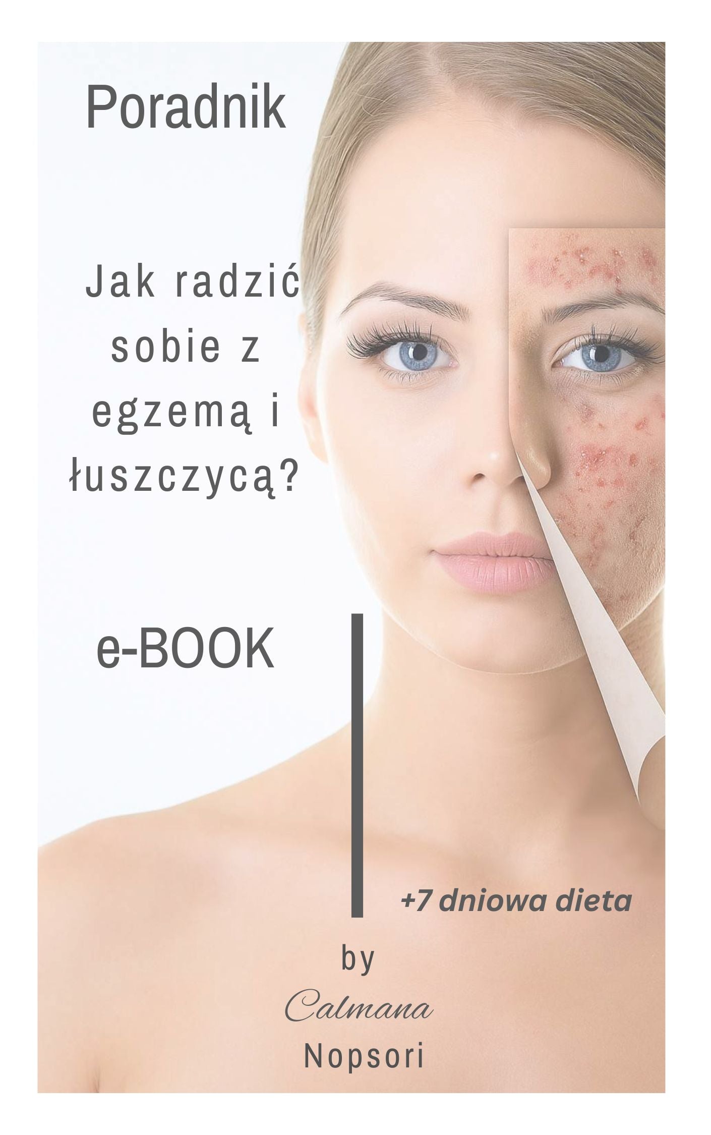Jak żyć z egzemą i łuszczycą – praktyczny przewodnik (eBook)